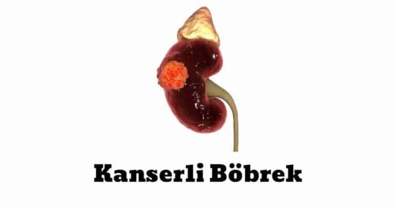 bobrek kanseri