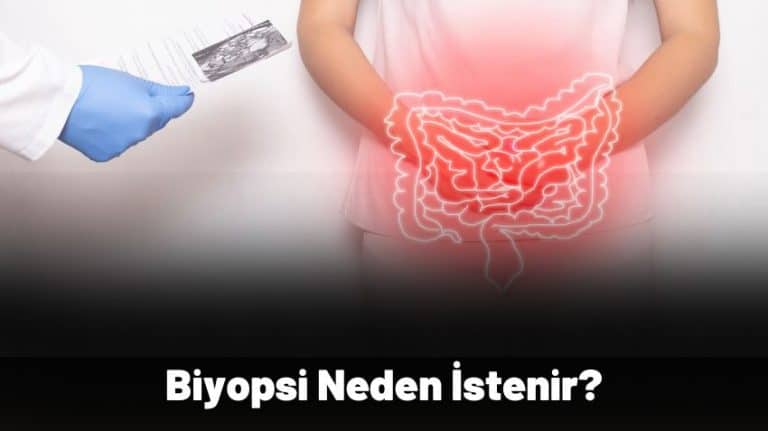 biyopsi-nedir