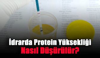 idrarda-protein-yuksekligi-nasil-dusurulur