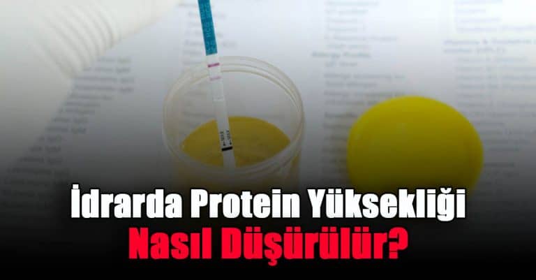 idrarda-protein-yuksekligi-nasil-dusurulur