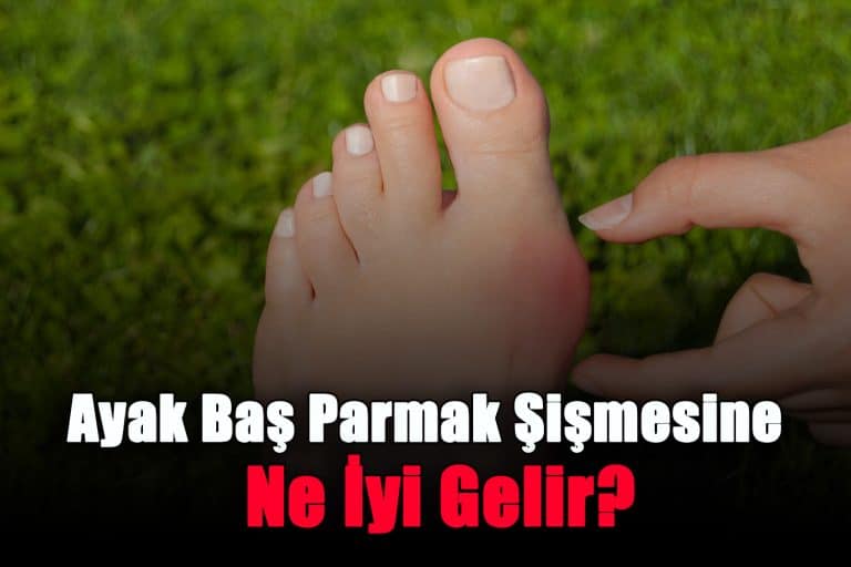 ayak-bas-parmak-sismesine-ne-iyi-gelir