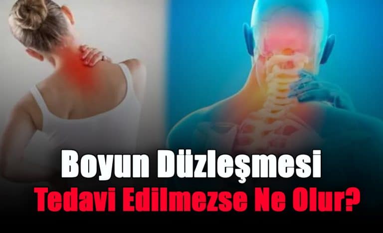 boyun-duzlesmesi-tedavi-edilmezse-ne-olur