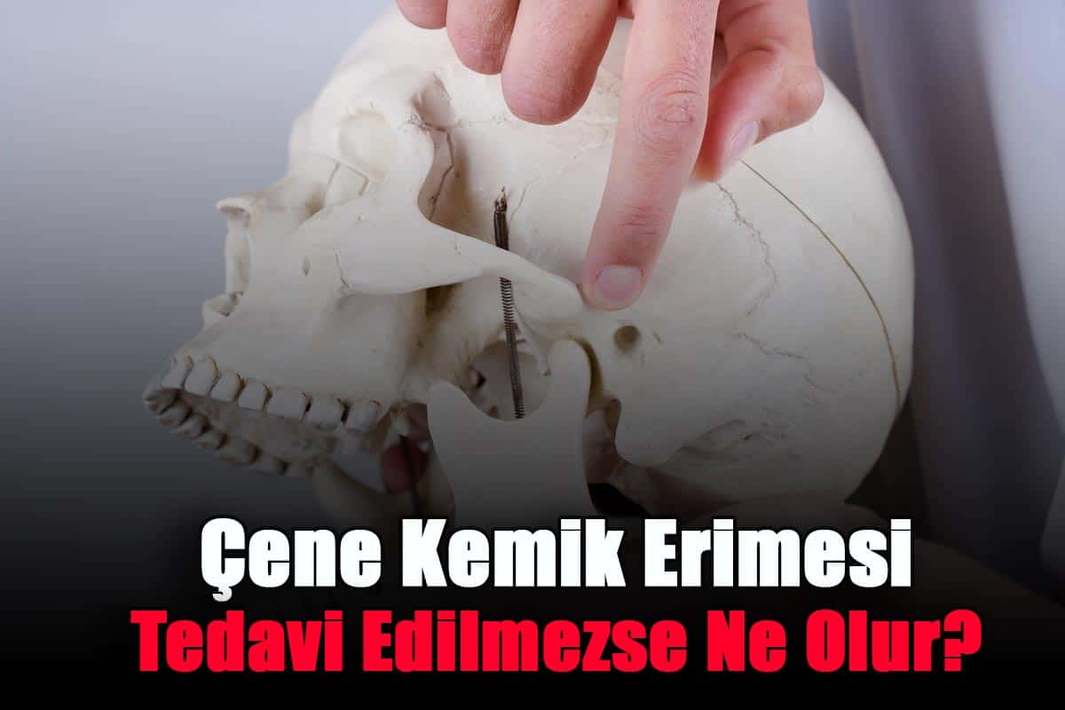 cene-kemik-erimesi-tedavi-edilmezse-ne-olur