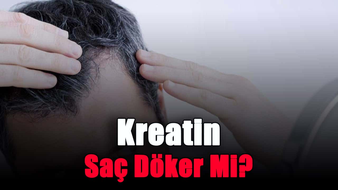 kreatin-sac-doker-mi