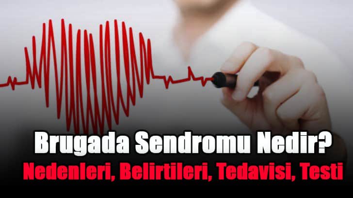 brugada-sendromu-nedir-nedenleri-belirtileri-tedavisi-testi