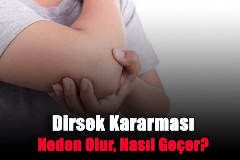 dirsek-kararmasi-neden-olur-nasil-gecer