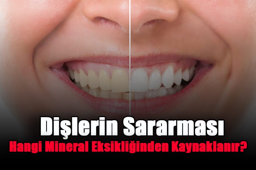 dislerin-sararmasi-hangi-mineral-eksikliginden-kaynaklanir