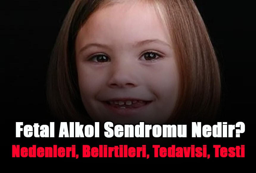 fetal-alkol-sendromu-nedir-nedenleri-belirtileri-tedavisi-testi