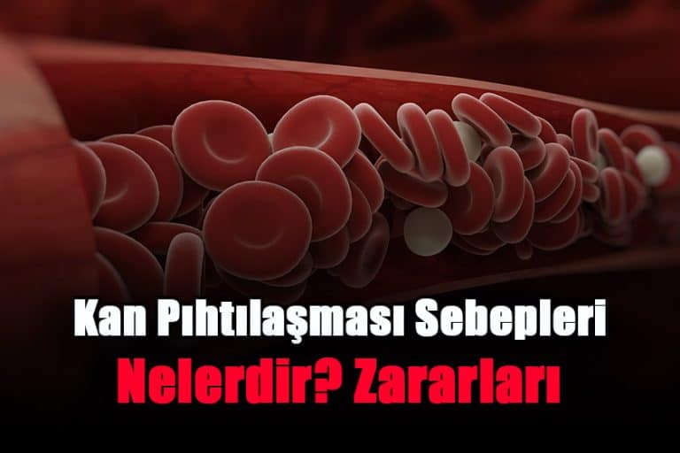 kan-pihtilasmasi-sebepleri-nelerdir-zararlari