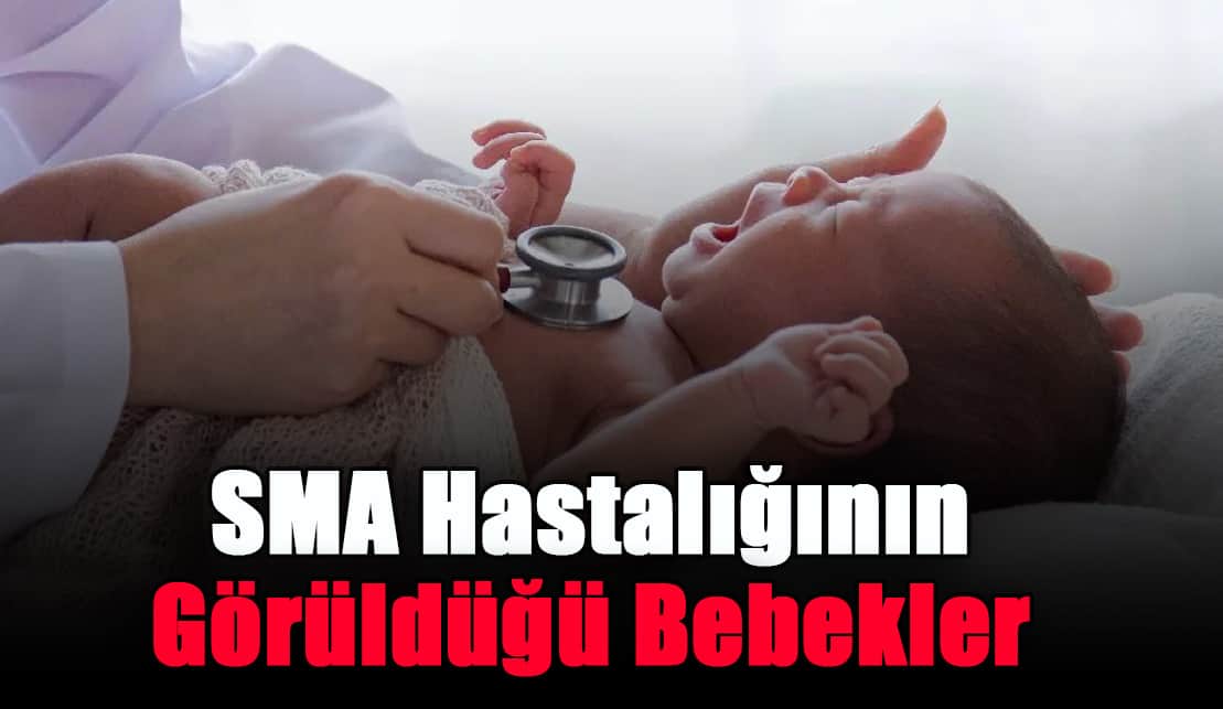 sma-hastaliginin-goruldugu-bebekler