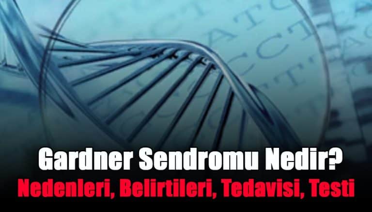 gardner-sendromu-nedir-nedenleri-belirtileri-tedavisi-testi