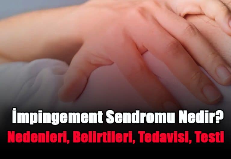 impingement-sendromu-nedir-nedenleri-belirtileri-tedavisi-testi