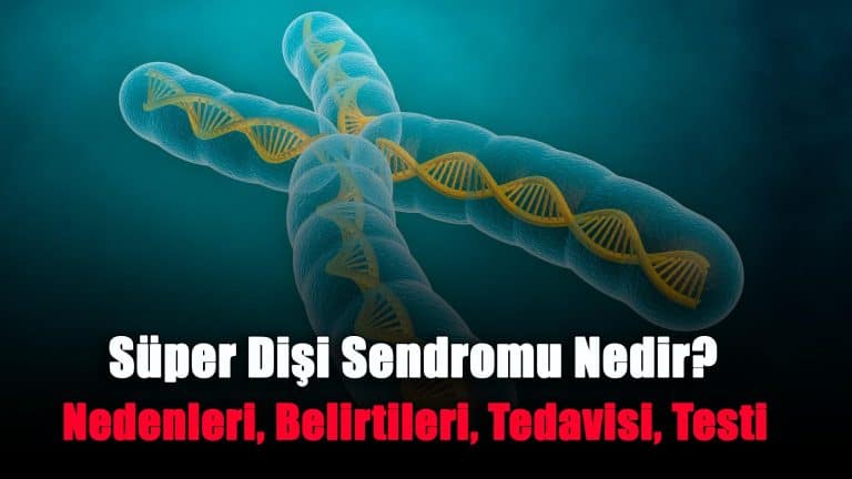 super-disi-sendromu-nedir-nedenleri-belirtileri-tedavisi-testi