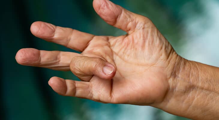 tetik parmak nedir belirtileri ve etkili tedavi yöntemleri