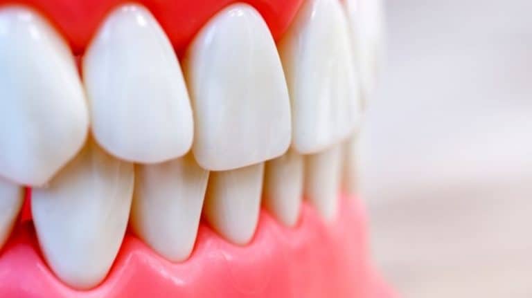zirkonyum diş modelleri (1)