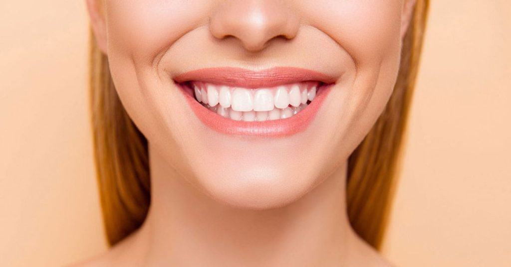 diş estetiği nedir? 2 dis-estetigi-nedir-2